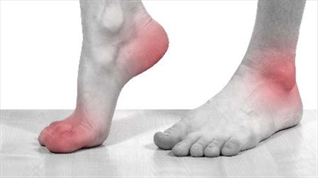 Điều trị gout: khó mà dễ!