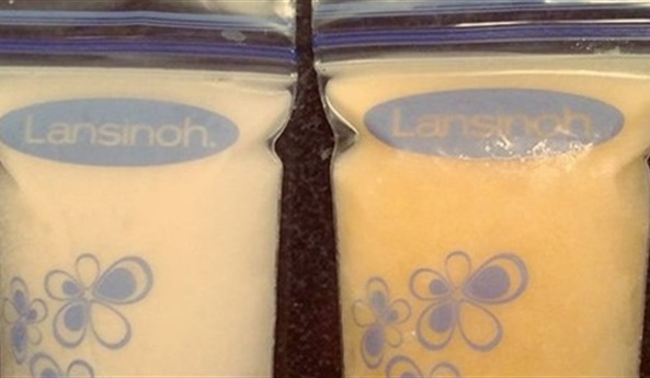 Chuyện túi sữa đổi màu khiến bạn nhận ra sữa mẹ kỳ diệu thế nào!