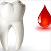 Chảy máu chân răng là triệu chứng bệnh nguy hiểm?