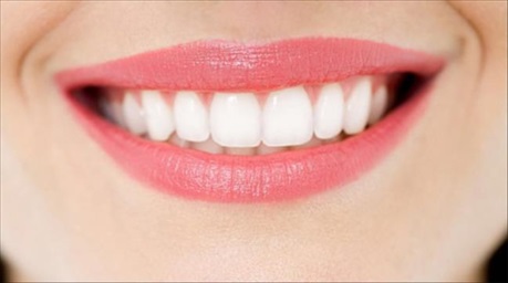 Tẩy trắng răng có thực sự an toàn?