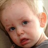 Những sai lầm nghiêm trọng mà phụ huynh cần tránh khi chăm sóc trẻ bị sốt xuất huyết