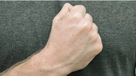 7 bài tập giúp giảm tình trạng đau của chứng viêm khớp tay