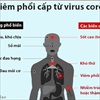 Cách phân biệt dấu hiệu nhiễm virus corona và cảm, sốt thông thường