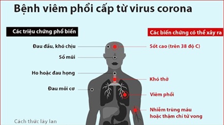 Cách phân biệt dấu hiệu nhiễm virus corona và cảm, sốt thông thường