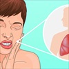 5 cơn đau dễ nhầm lẫn với đau răng nhưng thực chất là dấu hiệu của bệnh khó chữa