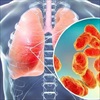 Vì sao biến thể Omicron không ảnh hưởng đến phổi mặc dù lây lan với tốc độ đáng báo động?
