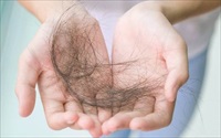 Người bị rụng tóc thường xuyên có tỷ lệ mắc ung thư da đầu cao hơn
