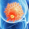 Đột phá mới: Các nhà khoa học tìm ra cách tiêu diệt tế bào khối u vú 'ngủ đông', ngăn ngừa bệnh tái phát