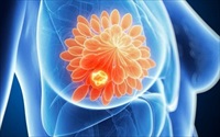 Đột phá mới: Các nhà khoa học tìm ra cách tiêu diệt tế bào khối u vú 'ngủ đông', ngăn ngừa bệnh tái phát
