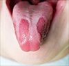 Cảnh báo sức khỏe thông qua tình trạng của lưỡi, kiểm tra ngay xem có bệnh không?